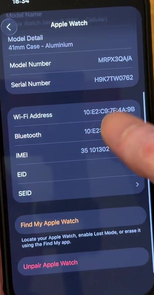 Apple Watch information screen with Unpair Apple Watch shown in red at the bottom
